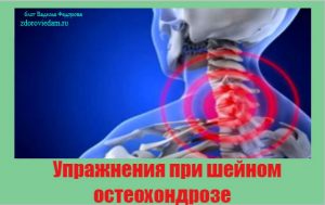 uprazhneniya-pri-shejnom-osteohondroze